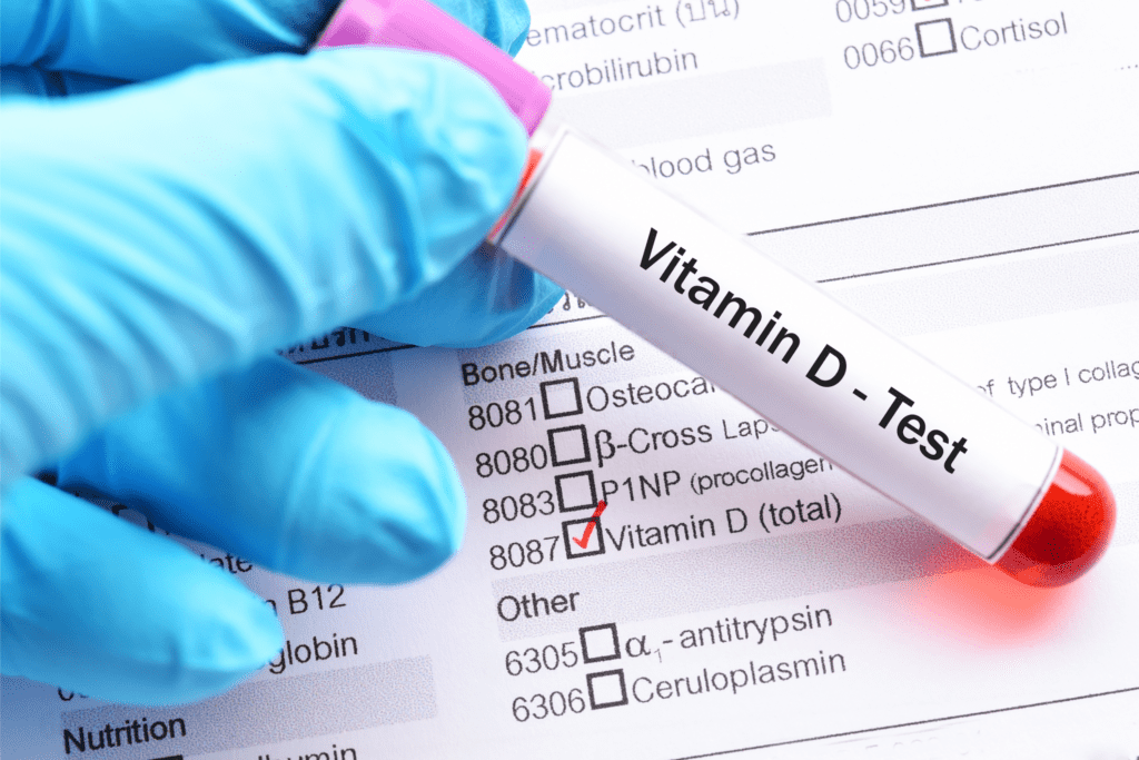 Vitamin D testing