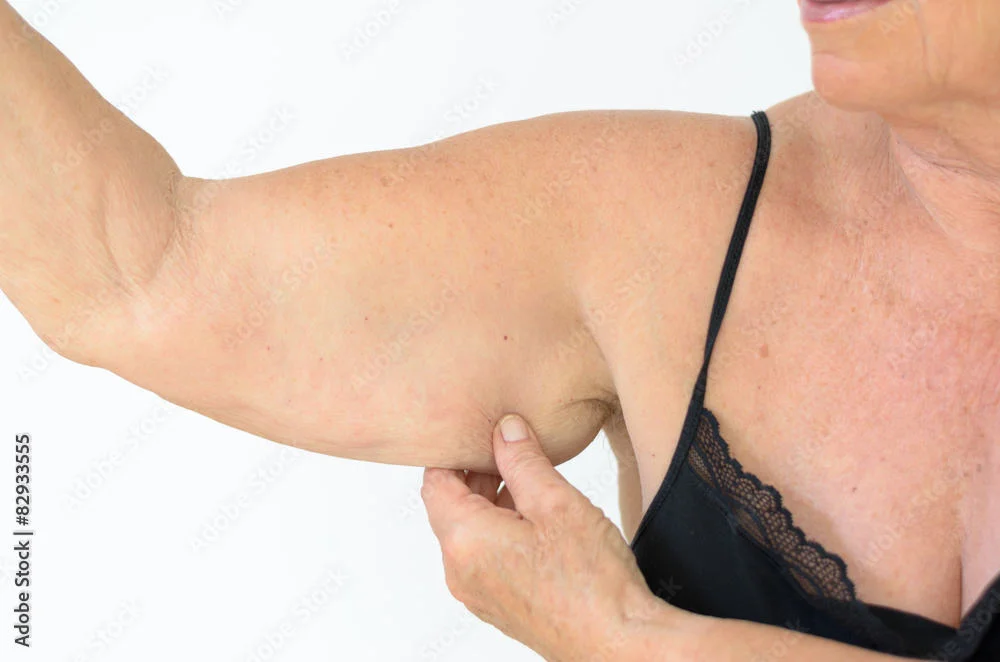 Can You Get Rid of Flabby Arms at 60?